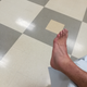 Illustration for article titled Update on the Ankle